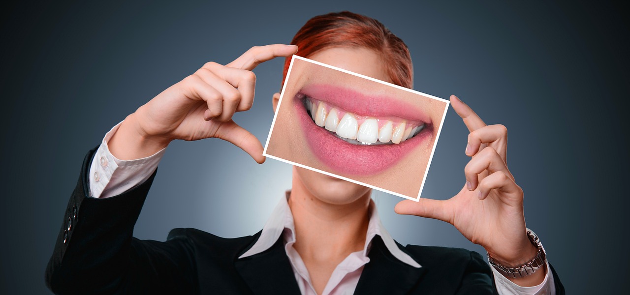 Три начина за безопасно избелване на зъбите Всеки човек мечтае